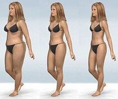Stages to lose weight